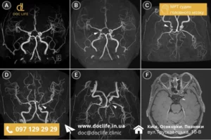 Кваліфіковані Лікарі Проводять Мрт Судин Головного Мозку В Doclife Київ Осокорки Позняки