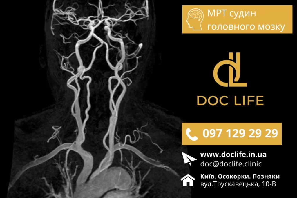 Mrt Diagnostyka Sudyn Golovnogo Mozku V Medychnomu Czentri Doclife Osokorky Poznyaky