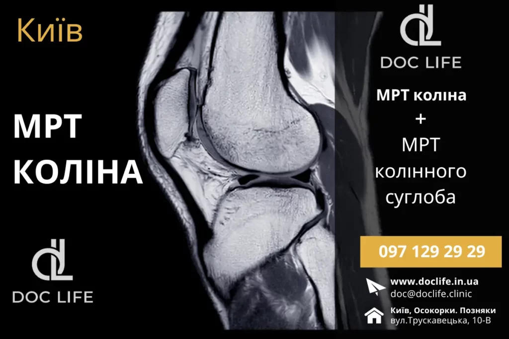 Мрт Колінного Суглоба Мрт Коліна Київ Клініка Док Лайф Осокорки