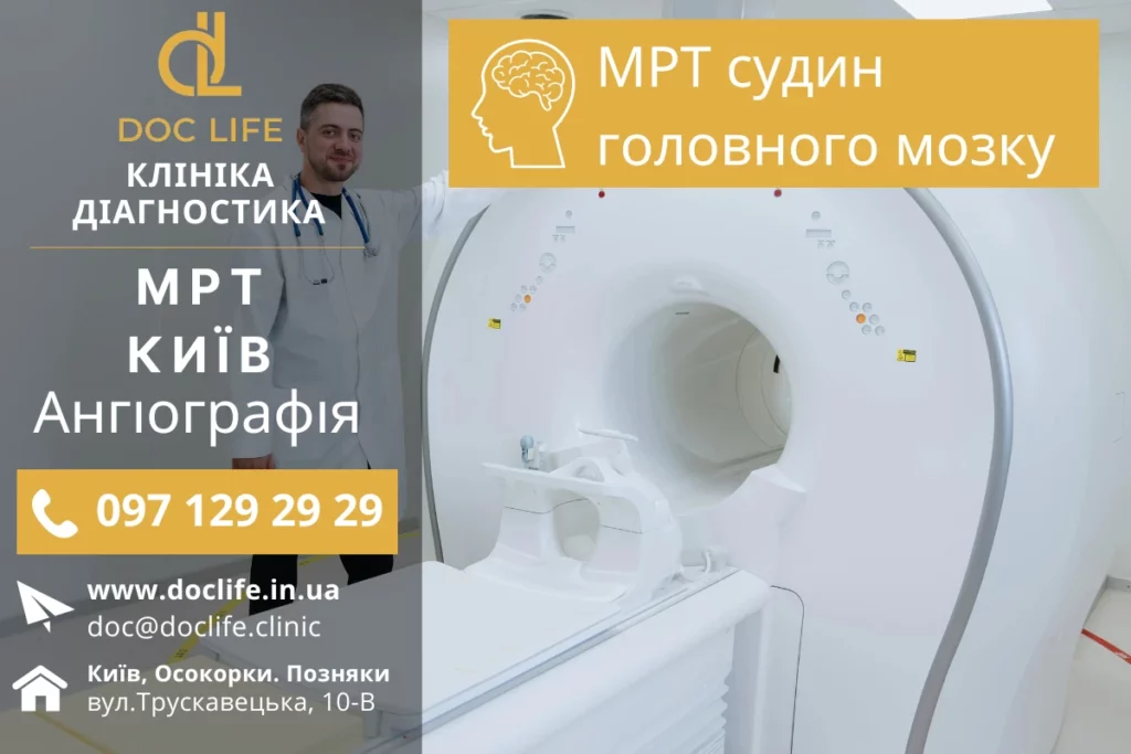 Мрт Судин Головного Мозку Київ У Клініці Doclife Позняки Осокорки