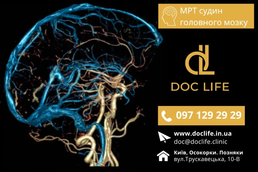 Обстеження Судин Головного Мозку Методом Мрт В Осокорках Мр Ангіографія Київ Мрт Ангіографія Судин Головного Мозку З Контрастуванням