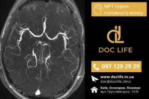 Сучасне Мрт Судин Головного Мозку На Позняках Мр Ангіографія Київ