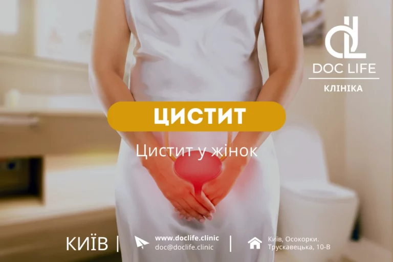 Цистит У Жінок Лікування Діагностика Гінеколог Київ Осокорки Doc Life 1