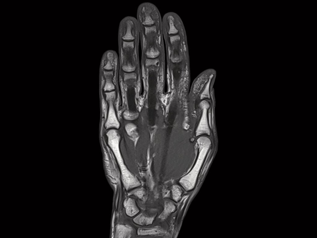 Mri Magnetom Orthopedics
