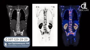 Мрт Онкоскринінг Київ Пошук Метастазів Мрт Центр Док Лайф