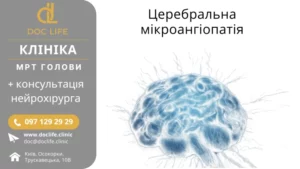 Церебральна Мікроангіопатія Діагностики Та Лікування В Києві Скіжа Наталія Нейрохірургія Києва