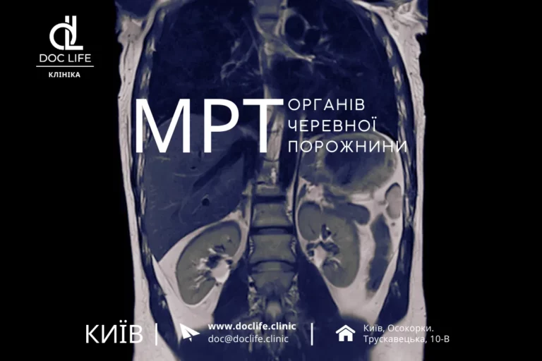 Мрт Органів Черевної Порожнини, Мрт Шлунку Київ Осокорки Doc Life 2