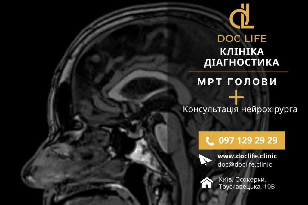 Ціни На Мрт Головного Мозку В Клініці Doclife Від 2100 Грн