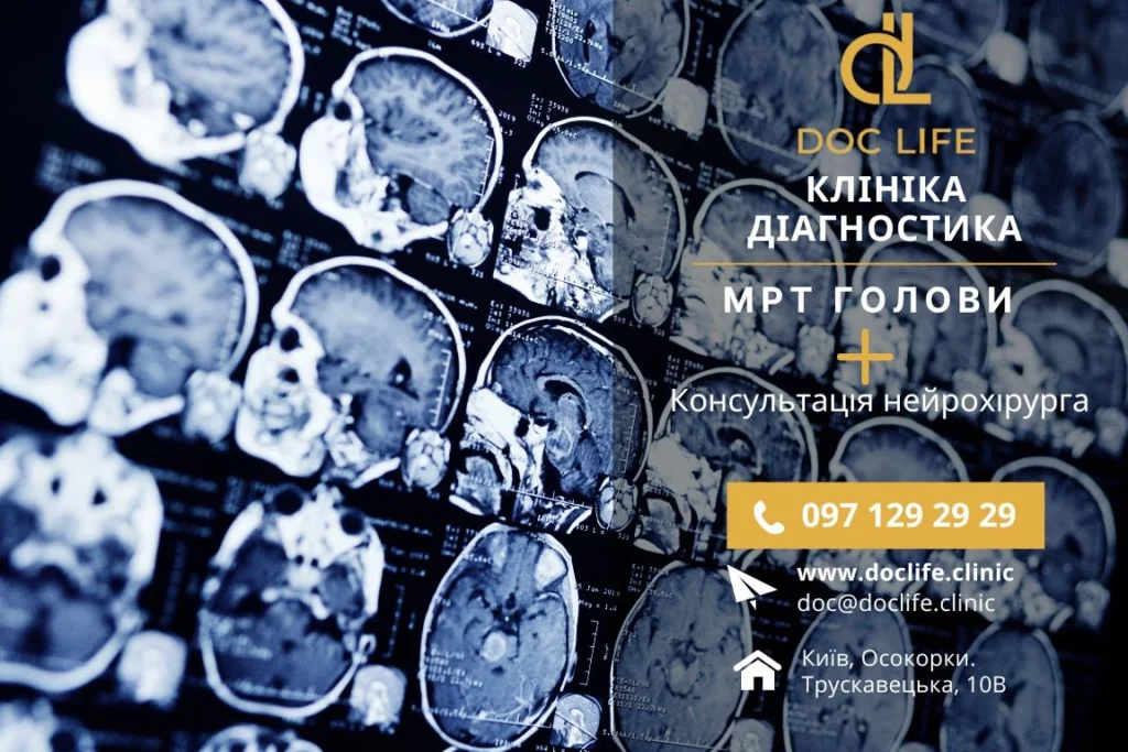 Мрт Головного Мозку У Клініці Doclife Київ, Мрт Голови Київ, Мрт Голови