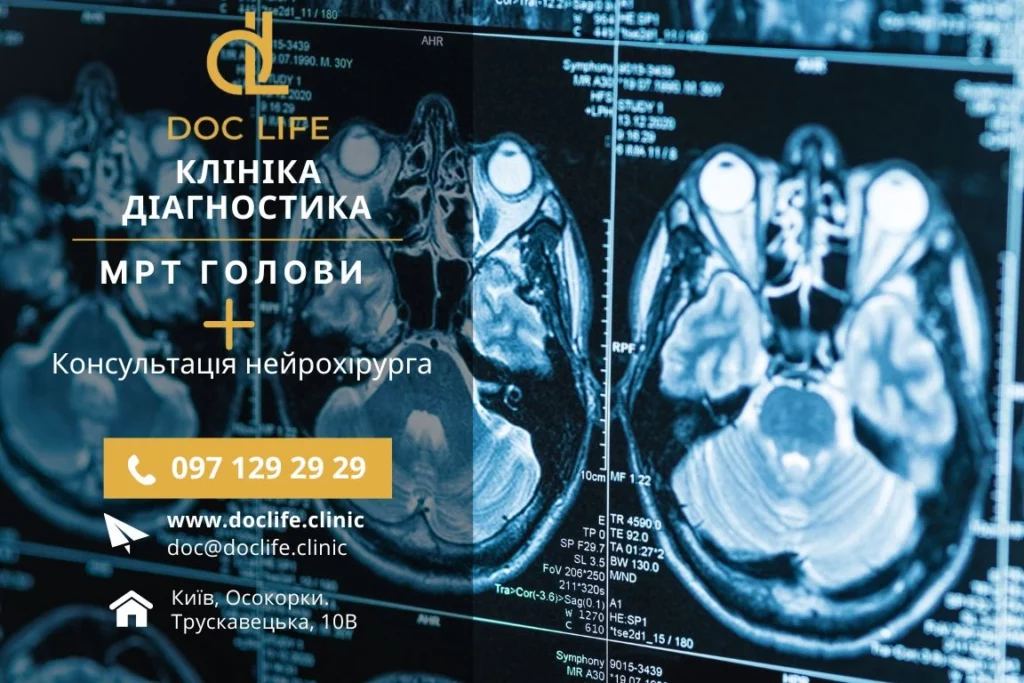 Мрт Головного Мозку У Клініці Doclife Київ, Мрт Голови Київ, Мрт Голови Ціни На Мрт Голови