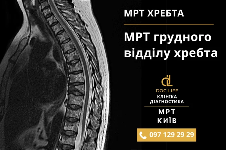 Мрт Грудного Відділу Хребта Київ — Ціна На Мрт Грудного Відділу