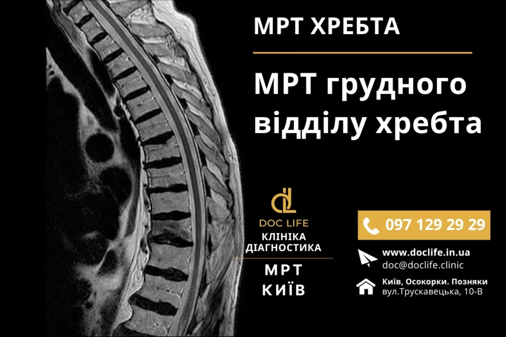 Мрт Грудного Відділу Хребта Київ — Ціна На Мрт Грудного Відділу
