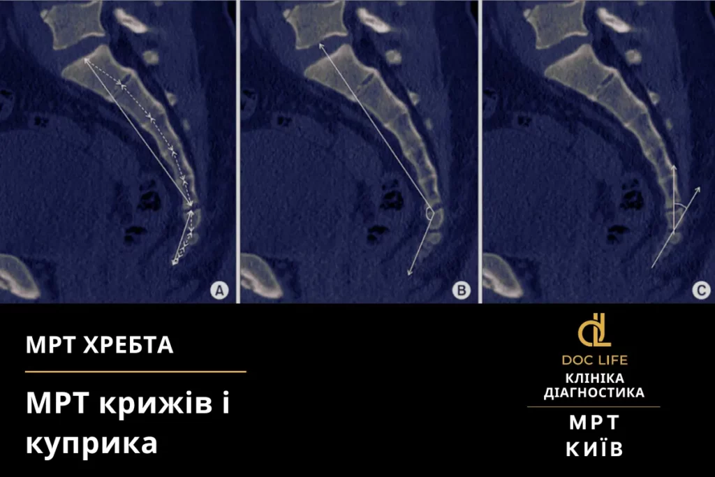 Мрт Хребта Київ Осокорки Doc Life