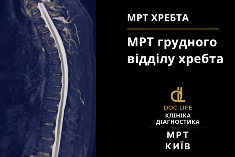 Мрт Грудного Відділу Хребта Київ — Ціна На Мрт Грудного Відділу