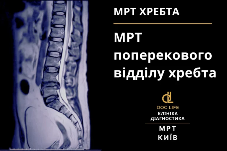 Мрт Поперекового Відділу Хребта Київ Осокорки Doc Life 3