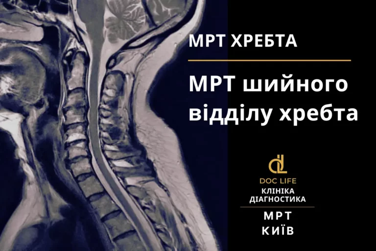 Мрт Шийного Відділу Хребта Київ - Мрт Хребта Мрт Спини Київ Осокорки Позняки