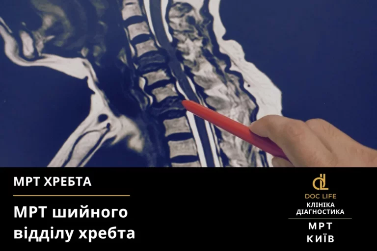 Мрт Шийного Відділу Хребта У Києві Київ Осокорки Doc Life 8