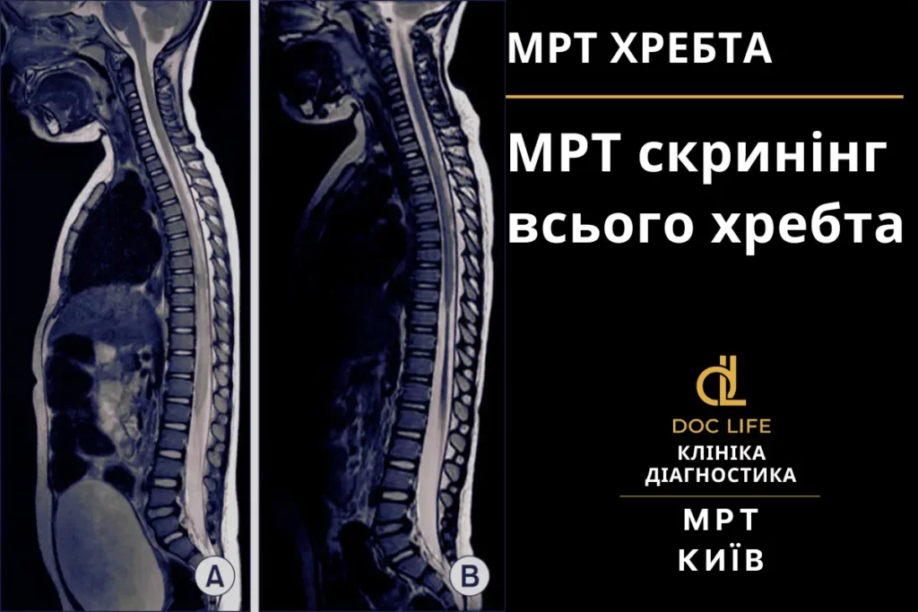 Діагностика При Болі В Спині