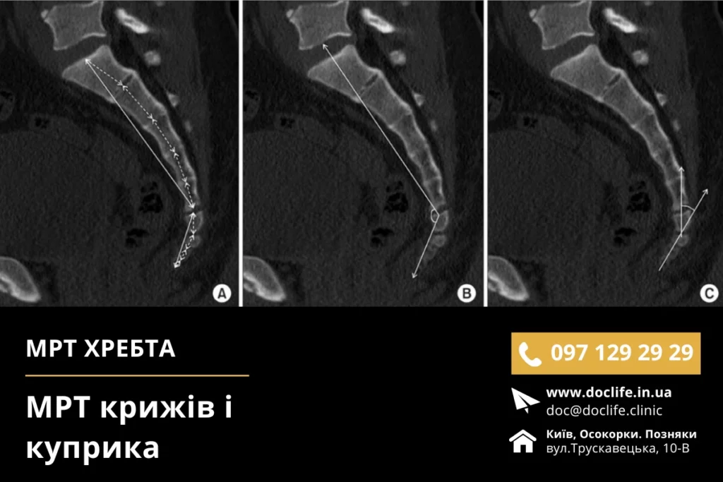 Мрт Крижів Та Куприка Київ Мрт Хребта Мрт Позняки Осокорки Запис