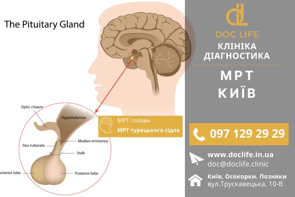 Мрт Київ Магнітно-Резонансна Томографія Турецького Сідла Мрт Турецького Сідла Київ Діагностика Позняки Осокорки