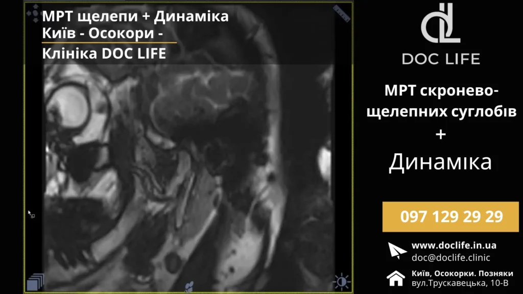 Мрт Щелепи Київ – Мрт Скронево-Нижньощелепних Суглобів Та Щелепи Клініка Док Лайф