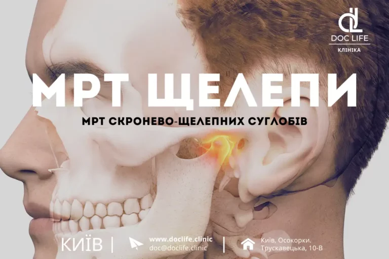 Мрт Щелепи Мрт Скронево-Нижньощелепних Суглобів Київ Осокорки Doc Life 2