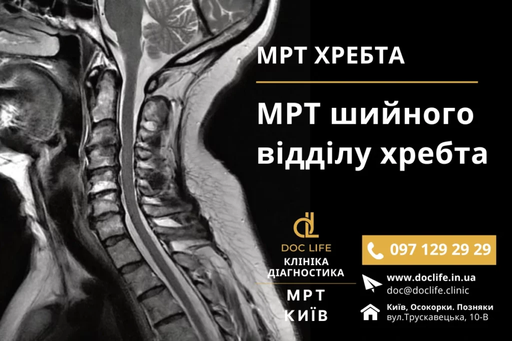 Мрт Шийного Відділу Хребта Київ - Мрт Хребта Мрт Спини Київ Осокорки Позняки