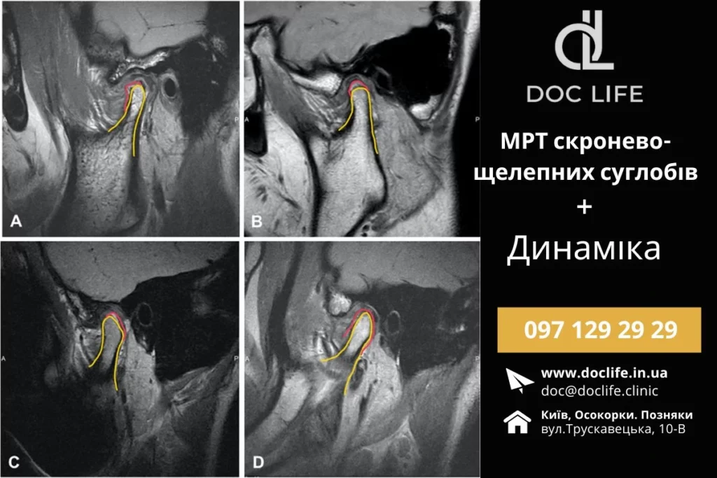 Мрт Скронево-Нижньощелепних Суглобів Та Мрт Щелепи Київ Мрт Щелепи Док Лайф Осокорки