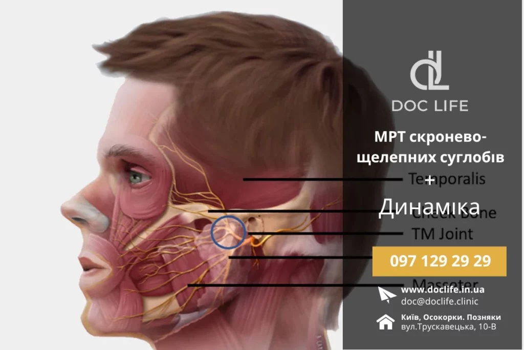 Мрт Скронево-Нижньощелепних Суглобів Та Мрт Щелепи Київ Мрт Щелепи Док Лайф Осокорки