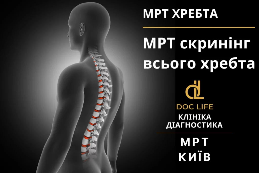 Мрт Скринінг Хребта Київ, Мрт Скринінг Всього Хребта Мрт Хребта Київ Позянки Осокорки