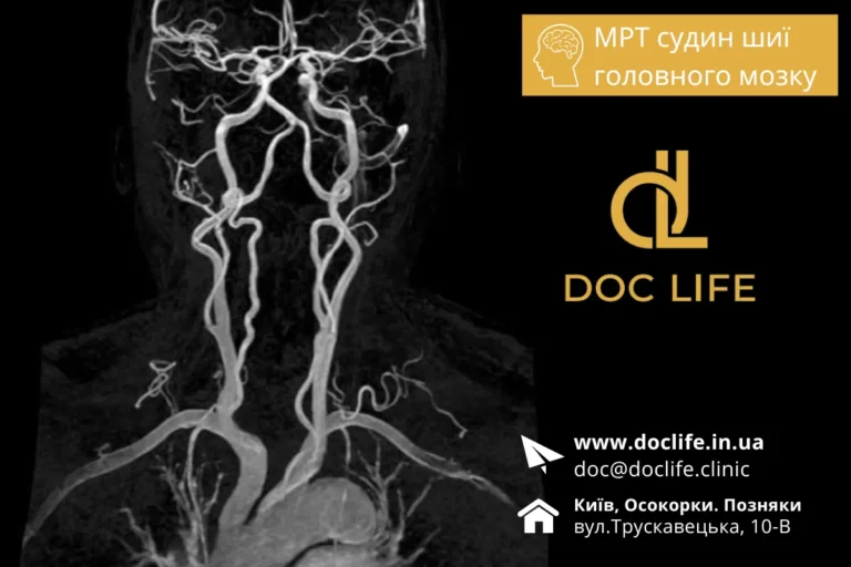 Мрт Судин Шиї - Мрт Судин Шийного Відділу Київ Осокорки Doc Life 9