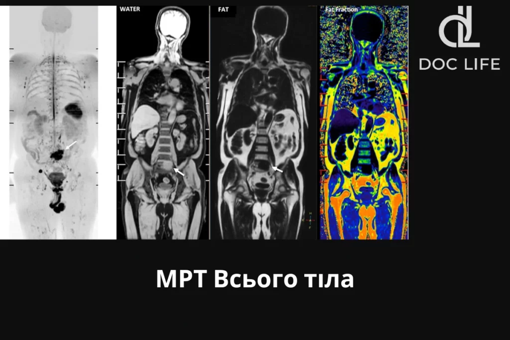 Мрт Всього Тіла Київ Мрт Всього Організму Осокорки