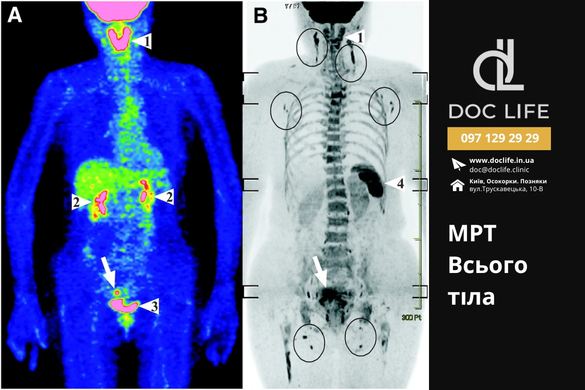 МРТ всього тіла в Києві в Клініці Док Лайф Осокорки Позняки