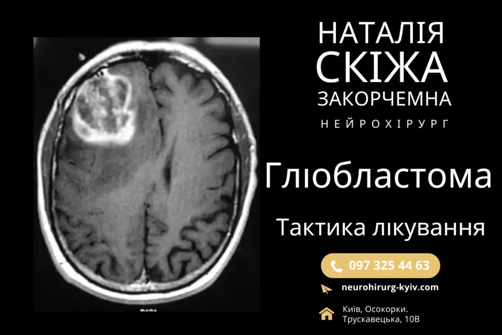 Тактика Лікування Гліобластома Головного Мозку Лікар Нейрохірург Наталія Скіжа Київ 4