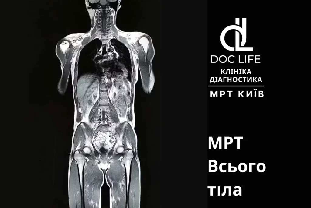 комплексне МРТ-обстеження всього організму в Києві Комплексне Мрт-Обстеження Всього Організму В Києві