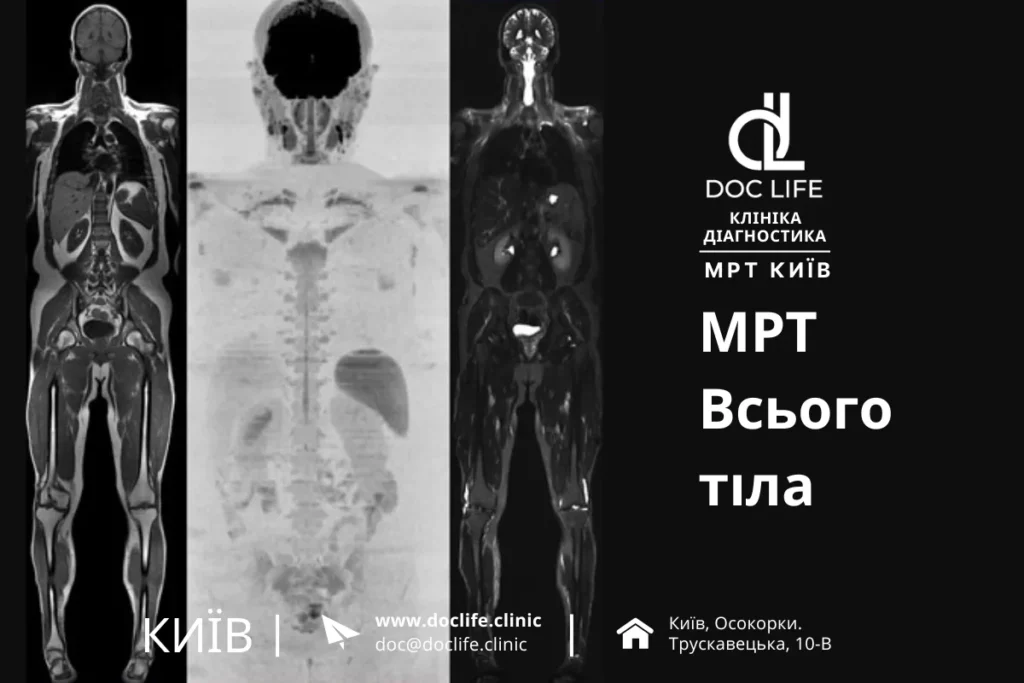 Мрт При Онкології: Коли Доцільніше За Кт