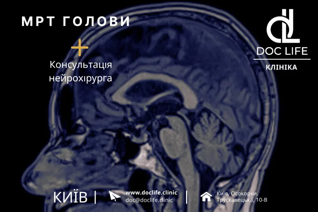 Розсіяний Склероз: Мрт При Розсіяному Склерозі Дослідження