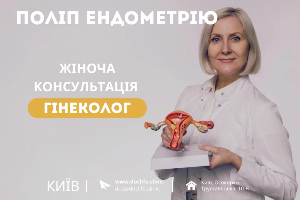 Polip Endometriyu Diagnoz N84 Prychyny Diagnostyka Ta Likuvannya V Kyyevi 2