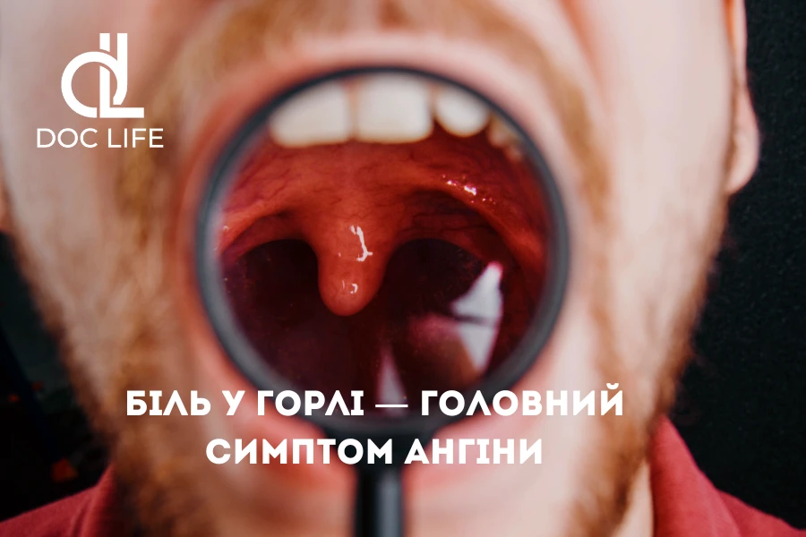 Консультація Лікаря При Ангіні В Клініці Doc Life Київ