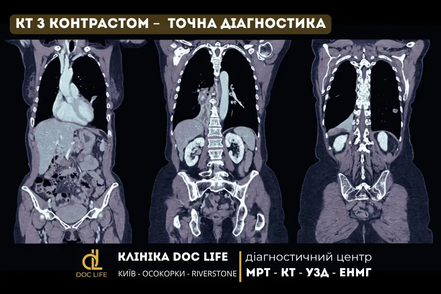 Кт З Контрастом У Києві – Точна Діагностика