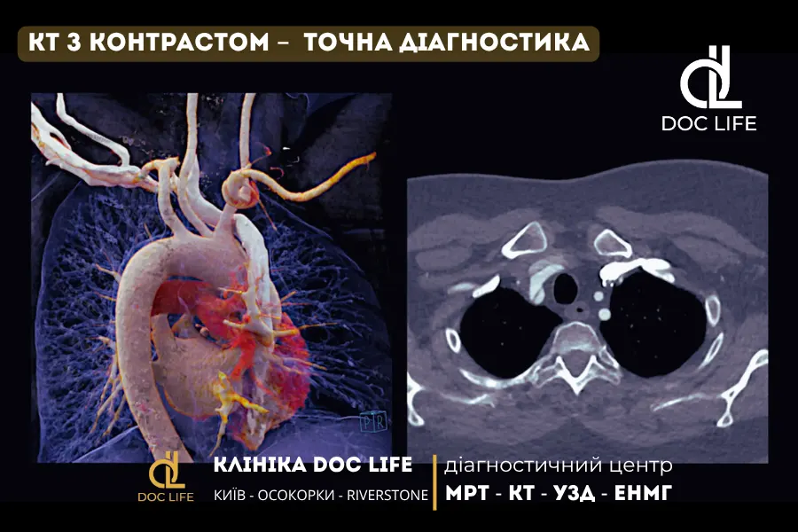 Кт Київ - Комп'ютерна Томографія Кт Діагностика