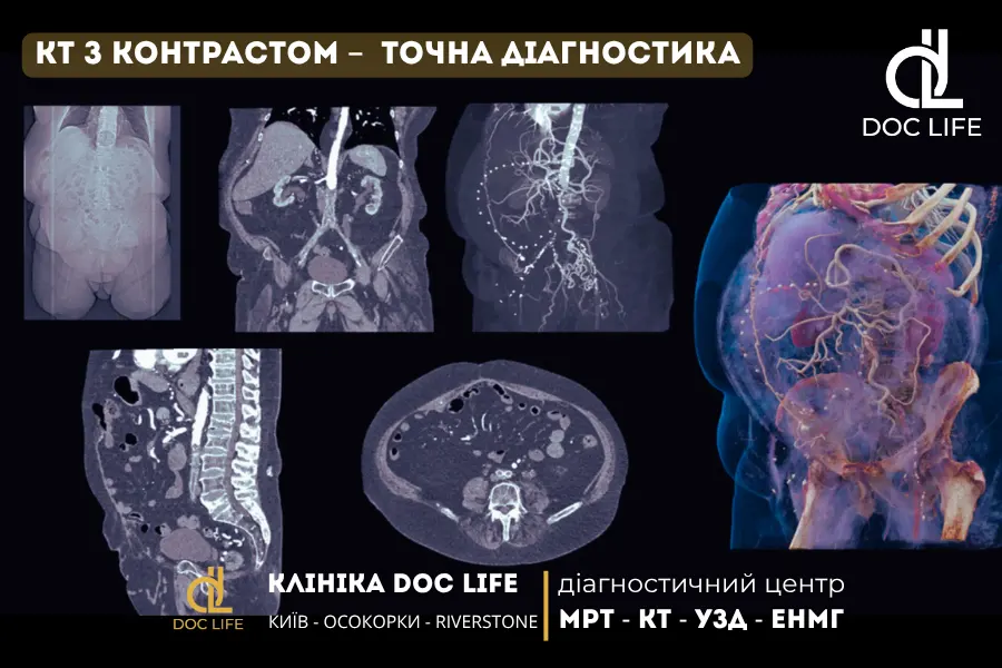 Кт З Контрастом — Скріншоти Знімків Різних Органів, Включно З Хребтом, Тазом І Судинами.