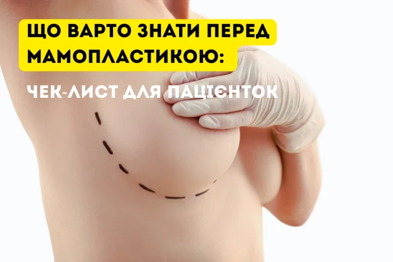 Що Потрібно Знати Перед Мамопластикою – Поетапна Підготовка До Операції