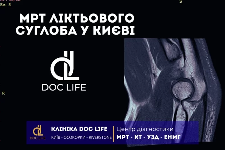 Мрт Ліктьового Суглоба У Києві 1