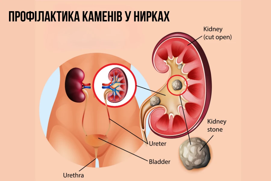 Osnovni Prynczypy Profilaktyky 5