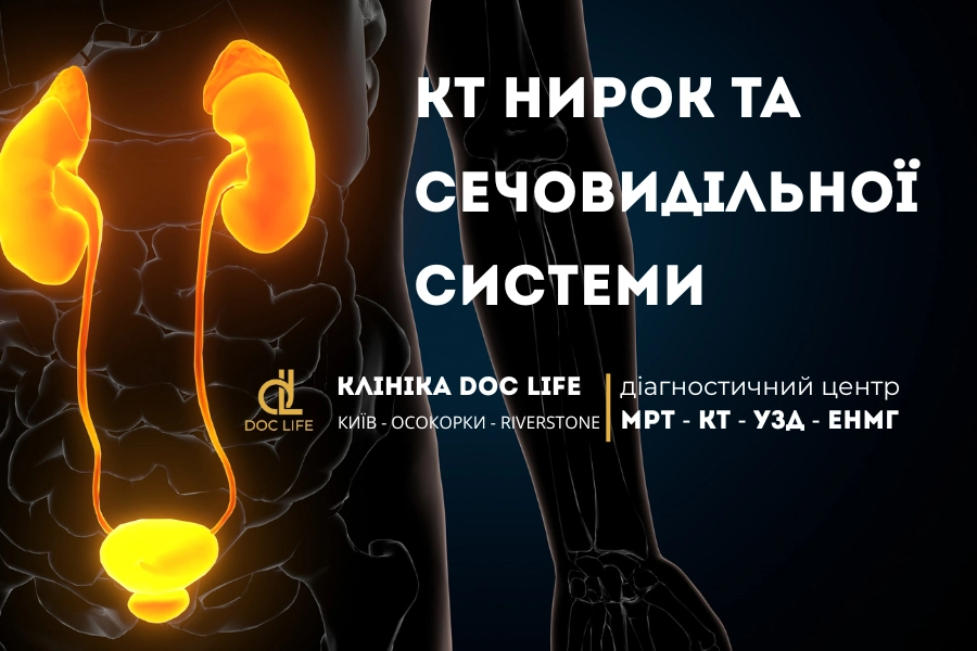 КТ нирок та сечовидільної системи: які патології можна знайти? 1 Кт Нирок Та Сечовидільної Системи