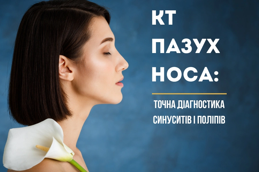Кт Пазух Носа 1