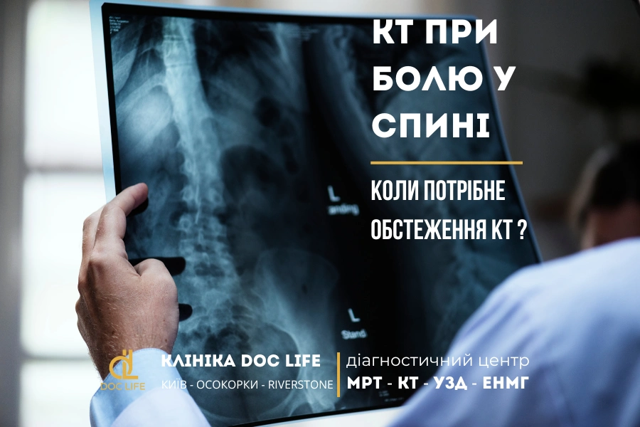 КТ при болю у спині: коли потрібне обстеження? Кт При Болю У Спині: Коли Потрібне Обстеження?