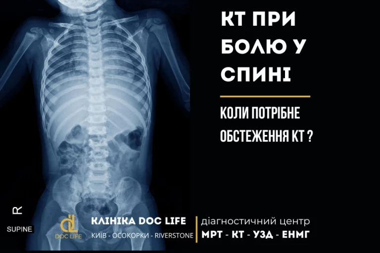 Кт При Болю У Спині Коли Потрібне Обстеження Кт?