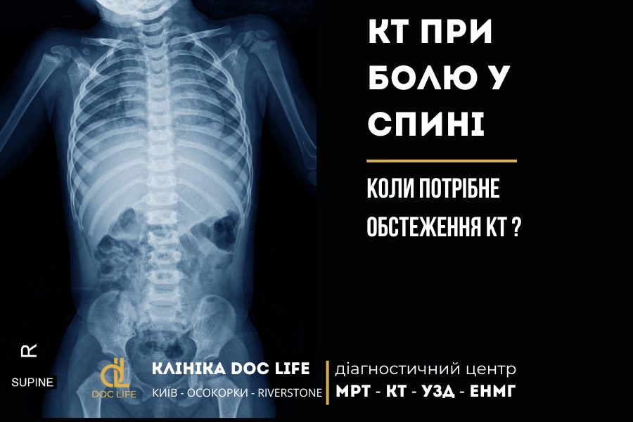 КТ при болю у спині: коли потрібне обстеження? 1 Кт При Болю У Спині Коли Потрібне Обстеження Кт?